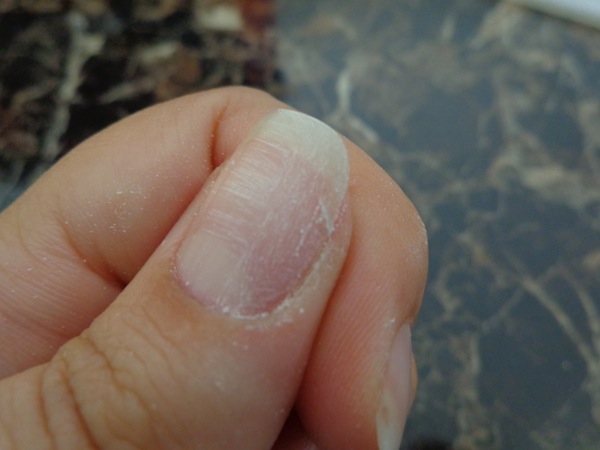 cracked nail that has been lightly buffed