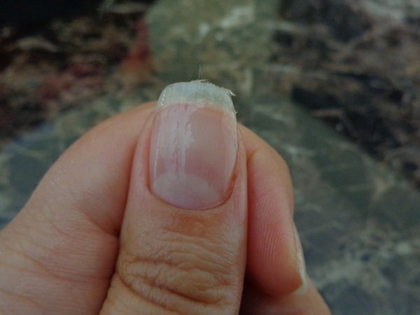 cracked nail with glue on top of the fiberglass strip