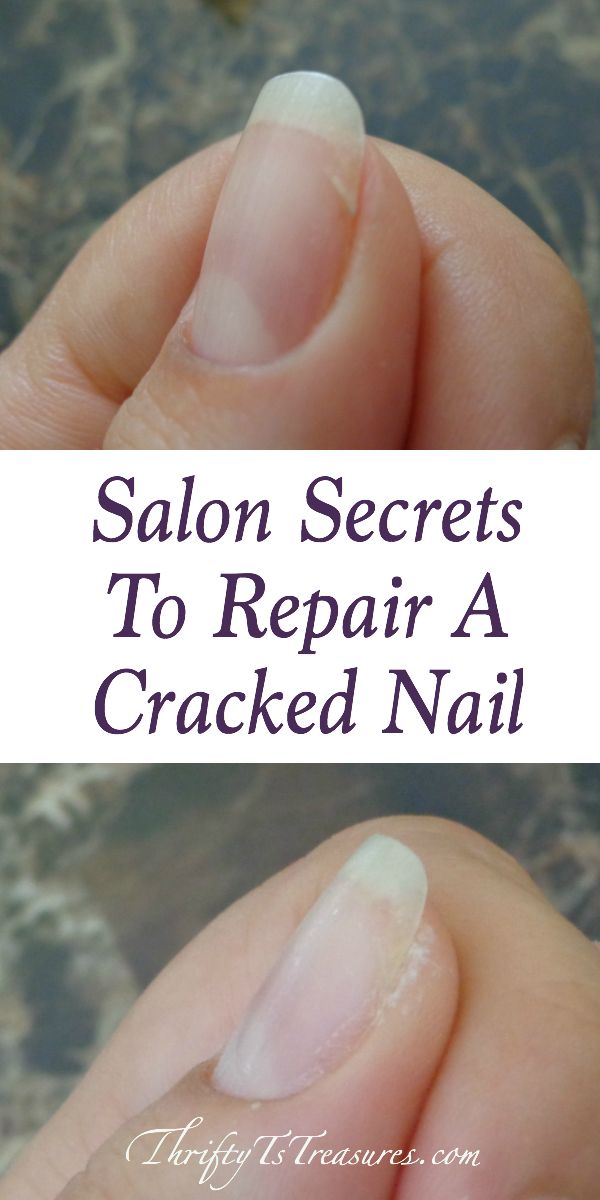 cracked nail and repaired nail